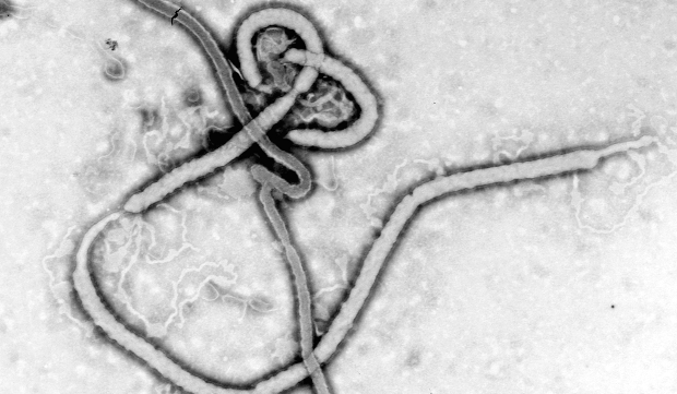 Ebola virus