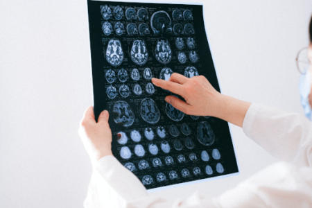 CAT Scan