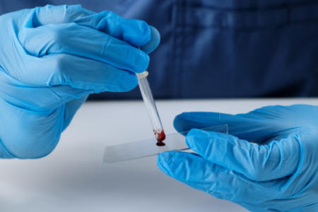 Blood Test